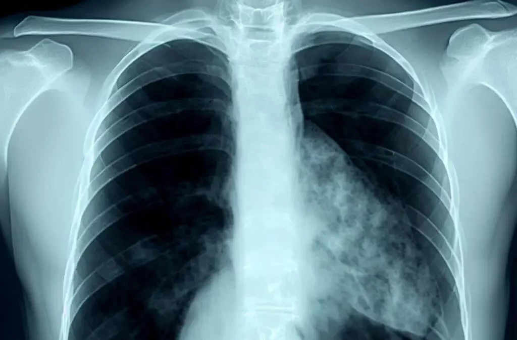 EPOC: el monitoreo muestra su impacto en medios digitales