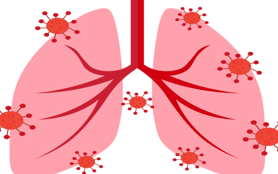 Bronquiolitis: el impacto en las redes sociales de esta enfermedad en Canarias